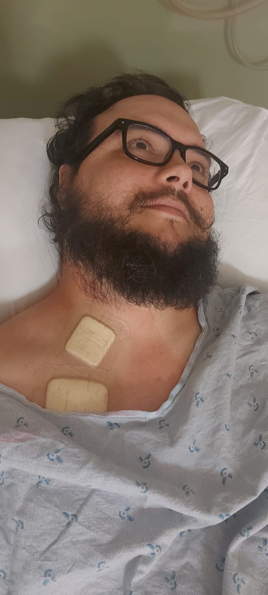 A man with short hair and bushy facial hair lies in a hospital bed like before, two bandages are visible